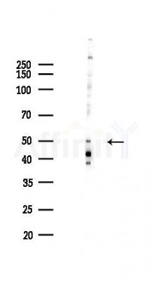 DPH1 Antibody - Western blot analysis of lysates from COLO205 cells(heat-shock,45min treatment), using DPH1 Antibody at 1/1000 dilution.