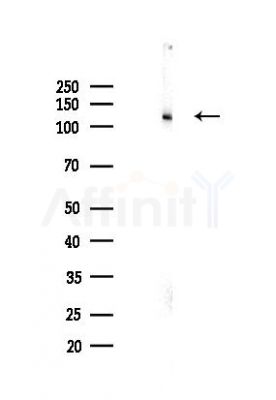 STXBP5 Antibody - Western blot analysis of lysates from Mouse liver, using STXBP5 Antibody at 1/1000 dilution.