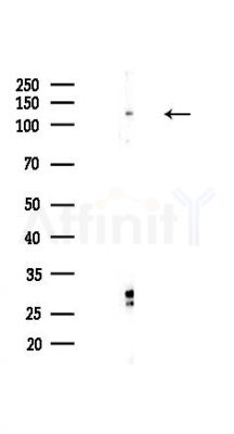 STXBP5 Antibody - Western blot analysis of lysates from Hela cells(heat-shock,45min treatment), using STXBP5 Antibody at 1/1000 dilution.
