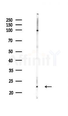 RPL9; RPL9P7; RPL9P8; RPL9P9 Antibody - Western blot analysis of lysates from Hela cells(heat-shock,45min treatment), using RPL9; RPL9P7; RPL9P8; RPL9P9 Antibody at 1/1000 dilution.