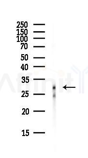 NOSIP Antibody - Western blot analysis of lysates from PC12 cells(starvation, 24h treatment), using NOSIP Antibody at 1/1000 dilution.