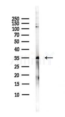 MAPK1IP1L Antibody - Western blot analysis of lysates from Hela cells(heat-shock,45min treatment), using MAPK1IP1L Antibody at 1/1000 dilution.