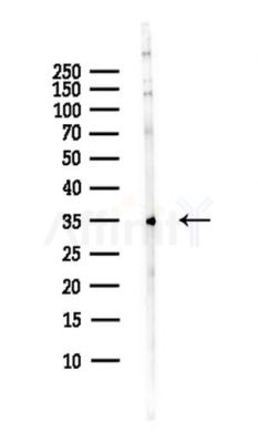 MAPK1IP1L Antibody - Western blot analysis of lysates from B16F10-LUC cells(starvation,24h treatment), using MAPK1IP1L Antibody at 1/1000 dilution.