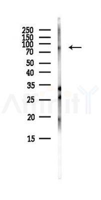 MFSD6 Antibody - Western blot analysis of lysates from PC12 cells(starvation, 24h treatment), using MFSD6 Antibody at 1/1000 dilution.