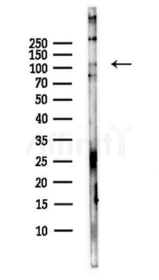 DENND1A Antibody - Western blot analysis of lysates from B16F10-LUC cells(starvation,24h treatment), using DENND1A Antibody at 1/1000 dilution.