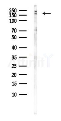 RERE Antibody - Western blot analysis of lysates from B16F10-LUC cells(starvation,24h treatment), using RERE Antibody at 1/1000 dilution.