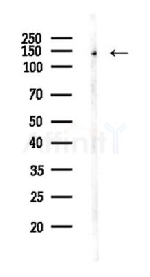DGKK Antibody - Western blot analysis of lysates from Mouse brain, using DGKK Antibody at 1/1000 dilution.