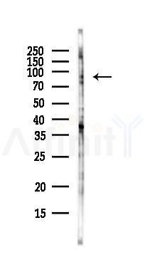 RNF10 Antibody - Western blot analysis of lysates from EC304 cells(LPS, 4h treatment), using RNF10 Antibody at 1/1000 dilution.