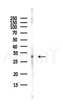 CTDSPL Antibody - Western blot analysis of lysates from EC304 cells(LPS, 4h treatment), using CTDSPL Antibody at 1/1000 dilution.