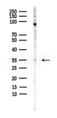 PVRIG Antibody - Western blot analysis of lysates from B16F10-LUC cells(starvation,24h treatment), using PVRIG Antibody at 1/1000 dilution.