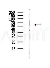MATN1 Antibody - Western blot analysis of lysates from HUVEC cells(UV,30min treatment), using MATN1 Antibody at 1/1000 dilution.