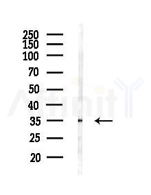 ST3GAL6 Antibody - Western blot analysis of lysates from Mouse liver, using ST3GAL6 Antibody at 1/1000 dilution.