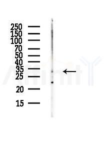 ELOVL7 Antibody - Western blot analysis of lysates from HUVEC cells(UV,30min treatment), using ELOVL7 Antibody at 1/1000 dilution.