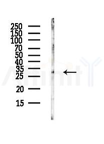 RNASET2 Antibody - Western blot analysis of lysates from HUVEC cells(UV,30min treatment), using RNASET2 Antibody at 1/1000 dilution.