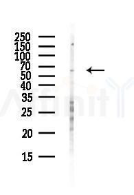 DRC3 Antibody - Western blot analysis of lysates from Hela cells(heat-shock,45min treatment), using DRC3 Antibody at 1/1000 dilution.
