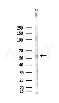 LMOD2 Antibody - Western blot analysis of lysates from B16F10-LUC cells(starvation,24h treatment), using LMOD2 Antibody at 1/1000 dilution.
