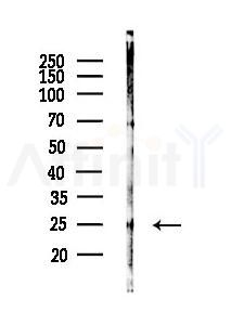 PYM1 Antibody - Western blot analysis of lysates from Mouse liver, using PYM1 Antibody at 1/1000 dilution.