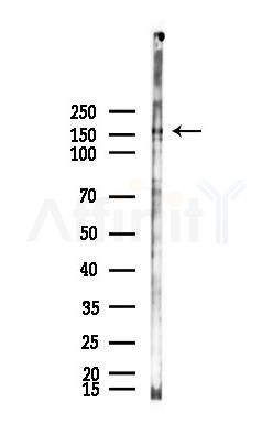 USP47 Antibody - Western blot analysis of lysates from B16F10-LUC cells(starvation,24h treatment), using USP47 Antibody at 1/1000 dilution.