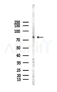WAC Antibody - Western blot analysis of lysates from Hela cells(LPS,4h treatment), using WAC Antibody at 1/1000 dilution.
