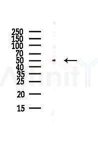 CRLF2 Antibody - Western blot analysis of lysates from HUVEC cells(UV,30min treatment), using CRLF2 Antibody at 1/1000 dilution.