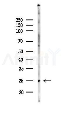 ARL2 Antibody - Western blot analysis of lysates from Rat brain, using ARL2 Antibody at 1/1000 dilution.
