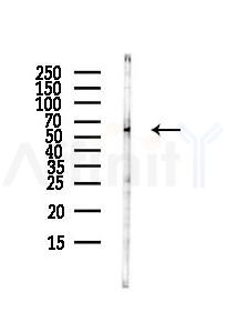 GALNT1 Antibody - Western blot analysis of lysates from HUVEC cells(UV,30min treatment), using GALNT1 Antibody at 1/1000 dilution.