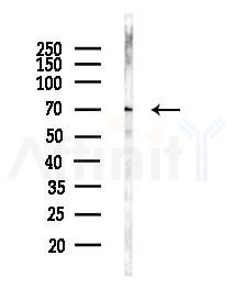 FRMD6 Antibody - Western blot analysis of lysates from Mouse liver, using FRMD6 Antibody at 1/1000 dilution.