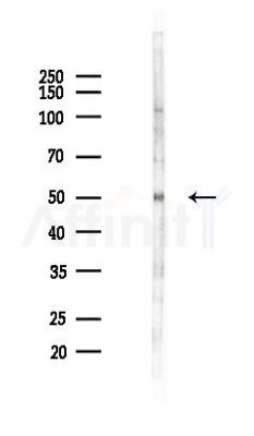 LILRA4 Antibody - Western blot analysis of lysates from Hela cells(LPS,4h treatment), using LILRA4 Antibody at 1/1000 dilution.