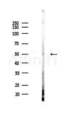 INPP5K Antibody - Western blot analysis of lysates from Hela cells(LPS,4h treatment), using INPP5K Antibody at 1/1000 dilution.