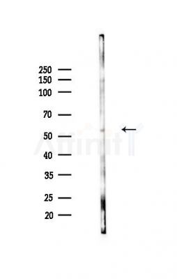 INPP5K Antibody - Western blot analysis of lysates from Mouse liver, using INPP5K Antibody at 1/1000 dilution.