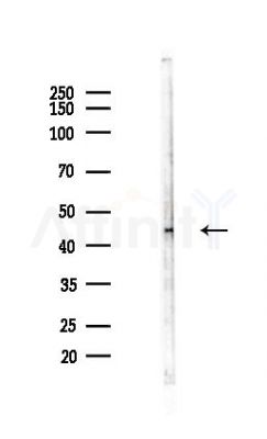 IDS Antibody - Western blot analysis of lysates from Hela cells(LPS,4h treatment), using IDS Antibody at 1/1000 dilution.