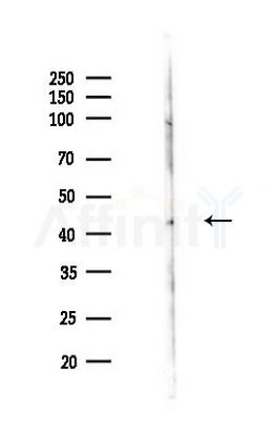 IDS Antibody - Western blot analysis of lysates from COLO205 cells(LPS,4h treatment), using IDS Antibody at 1/1000 dilution.