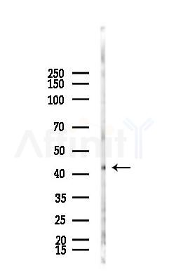 ABRA Antibody - Western blot analysis of lysates from B16F10-LUC cells(starvation,24h treatment), using ABRA Antibody at 1/1000 dilution.