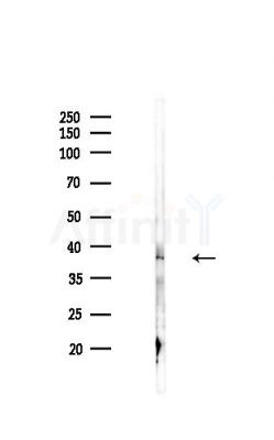 DTX3 Antibody - Western blot analysis of lysates from Mouse liver, using DTX3 Antibody at 1/1000 dilution.