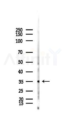 ZNF444 Antibody - Western blot analysis of lysates from B16F10-LUC cells(starvation,24h treatment), using ZNF444 Antibody at 1/1000 dilution.