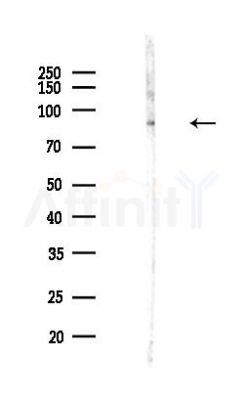 CEP85 Antibody - Western blot analysis of lysates from Hela cells(LPS,4h treatment), using CEP85 Antibody at 1/1000 dilution.