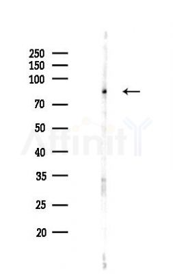 CEP85 Antibody - Western blot analysis of lysates from COLO205 cells(LPS,4h treatment), using CEP85 Antibody at 1/1000 dilution.