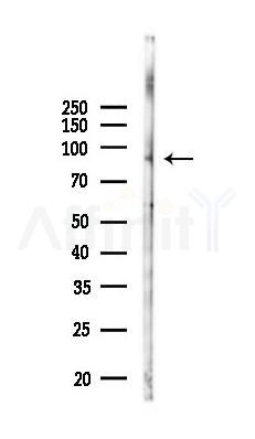 RASAL1 Antibody - Western blot analysis of lysates from Mouse lung, using RASAL1 Antibody at 1/1000 dilution.