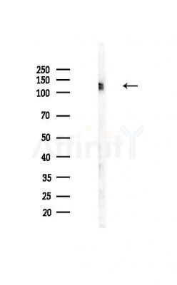 ESYT1 Antibody - Western blot analysis of lysates from Mouse liver, using ESYT1 Antibody at 1/1000 dilution.