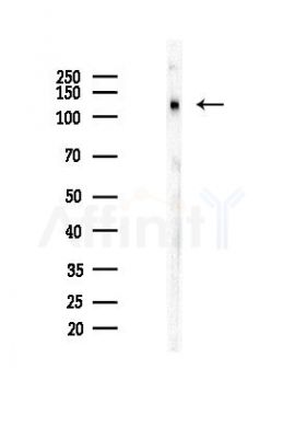 ESYT1 Antibody - Western blot analysis of lysates from Hela cells(LPS,4h treatment), using ESYT1 Antibody at 1/1000 dilution.