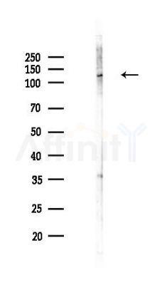 ESYT1 Antibody - Western blot analysis of lysates from COLO205 cells(LPS,4h treatment), using ESYT1 Antibody at 1/1000 dilution.