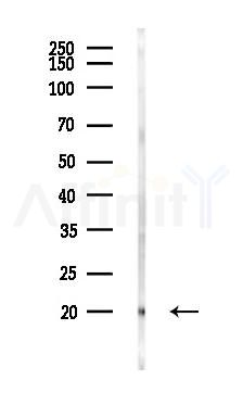 SSR2 Antibody - Western blot analysis of lysates from Rat liver, using SSR2 Antibody at 1/1000 dilution.