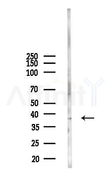 PRICKLE4 Antibody - Western blot analysis of lysates from MCF7 cells(heat-shock,45min treatment), using PRICKLE4 Antibody at 1/1000 dilution.
