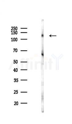 STON2 Antibody - Western blot analysis of lysates from COLO205 cells(heat-shock,45min treatment), using STON2 Antibody at 1/1000 dilution.