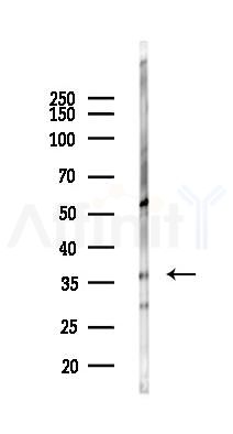 C1orf198 Antibody - Western blot analysis of lysates from Rat liver, using C1orf198 Antibody at 1/1000 dilution.