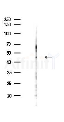 SYT7 Antibody - Western blot analysis of lysates from Hela cells(heat-shock,45min treatment), using SYT7 Antibody at 1/1000 dilution.