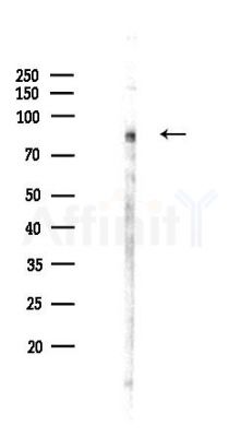 DNAJC14 Antibody - Western blot analysis of lysates from Hela cells(heat-shock,45min treatment), using DNAJC14 Antibody at 1/1000 dilution.