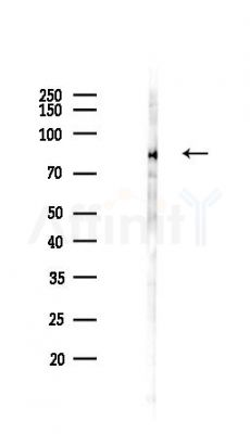 DNAJC14 Antibody - Western blot analysis of lysates from COLO205 cells(heat-shock,45min treatment), using DNAJC14 Antibody at 1/1000 dilution.