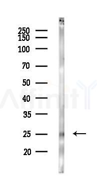 TMEM186 Antibody - Western blot analysis of lysates from Rat liver, using TMEM186 Antibody at 1/1000 dilution.
