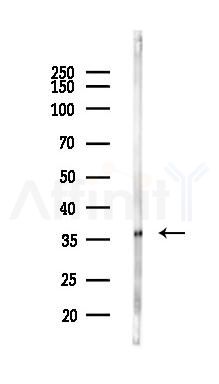 RWDD2B Antibody - Western blot analysis of lysates from Rat liver, using RWDD2B Antibody at 1/1000 dilution.